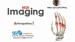 Arthropathies ( part 1) .. Prof.mamdouh Mahfouz (2019 edition)