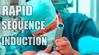Rapid Sequence Induction or rapid sequence intubation