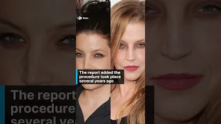 Lisa Marie Presley died of 'complications from weight loss surgery'