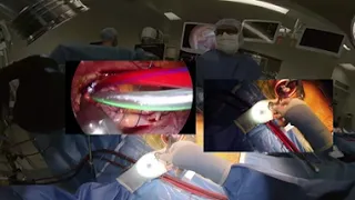 Novel 360-Degree Tutorial of Minimally Invasive Mitral Valve Surgery