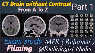ازاي تعمل اشعة مقطعية علي المخ بدون صبغة بطريقة سهلة | CT Brain without contrast from AtoZ on PH16MS