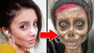 Top 10 Celebrities Before and After Plastic Surgery Pt-2