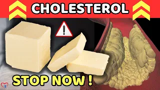 Your Cholesterol Will Skyrocket If You Eat These 10 Foods | Vitality Solutions