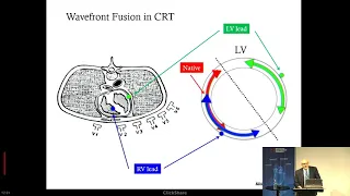 Alan Bank, MD | Electrical Dyssynchrony and Cardiac Resynchronization Therapy