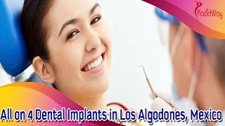 All-on-4 Dental Implants - Mouth Makeover in Los Algodones, Mexico