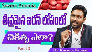 Severe Iron deficiency Anemia | Methods to increase Blood Faster | Dr Karuna Kumar | Hematologist