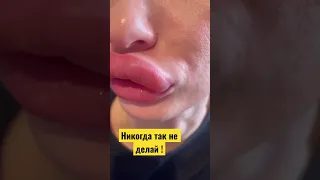 Перекаченные кривые губы самой себе #губы