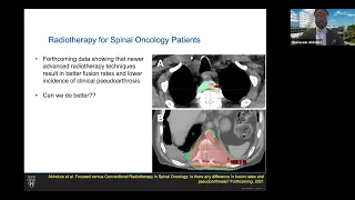 Lecture series: Oluwaseun O. Akinduro, M.D. 8-16-2021 - Mayo Clinic