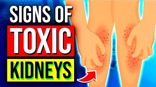 Don't Ignore The 9 Warning Signs of KIDNEY TOXICITY