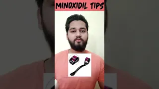 Minoxidil Beard Growth Tips 🔥 | Amazing Beard Transformation