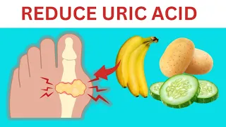 Top 8 Foods That Reduce Uric Acid Level Naturally