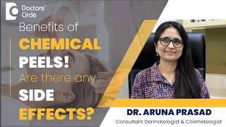 Chemical Peels For Acne Scar | Side Effects Of Chemical Peels #skin -Dr.Aruna Prasad|Doctors' Circle