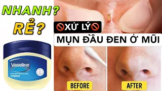 XỬ LÝ MỤN ĐẦU ĐEN, SỢI BÃ NHỜN TRÊN MŨI NHANH & RẺ | Có thực sự hiệu quả không???