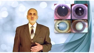 Elbromboly Basic ophthalmology IC Lens Senile cataract