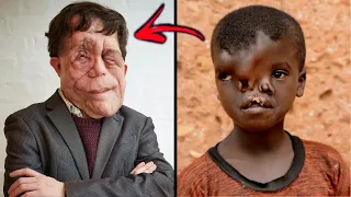 STRANGEST People Who Were Born Different