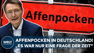 KARL LAUTERBACH: Affenpocken in Deutschland? "Es war nur eine Frage der Zeit" I WELT Dokument