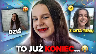 ZDJĘŁAM APARAT ORTODONTYCZNY?! TO JUŻ KONIEC..