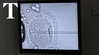 Alabama law affects IVF care after court ruling on frozen embryos