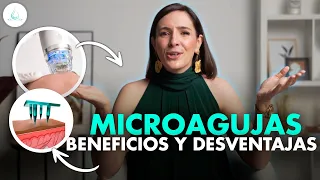 🔴 MICRONEEDLING (Demaroller, Dermapen, Nanopore) Lo que necesitas saber! @drapilarochoa -Dermatologa