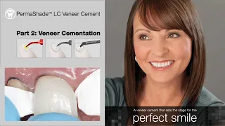 PermaShade LC Veneer Cementation Video