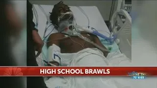 Student hospitalized after school fight