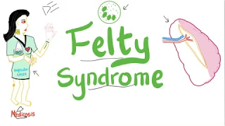 Felty Syndrome | The infamous Triad | Rheumatology