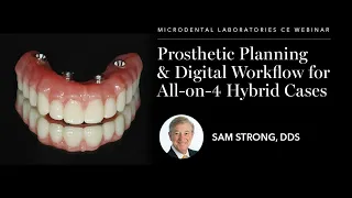 Sam Strong — Prosthetic Planning & Digital Workflow for All-on-4 Hybrid Cases