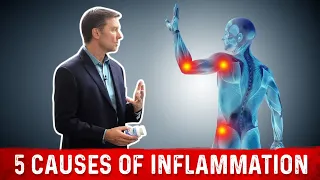 Stop the 5 Causes of Inflammation: FAST! – Dr. Berg