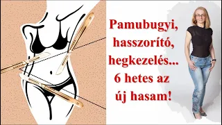 Kezdődik a hegkezelés! - 6 héttel hasplasztika után íme a pocakom!