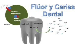 ¿Cómo protegen los fluoruros contra la caries dental?