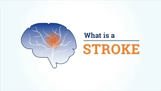 What is a stroke? What are the different types of strokes?