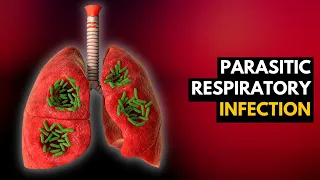 Parasitic Respiratory Infection: What Is This And How Do You Treat It