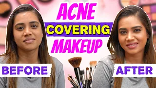 How To Cover Acne Prone Skin & Hyperpigmentation | Covering Acne Makeup | Aarthi Subash Vlogs