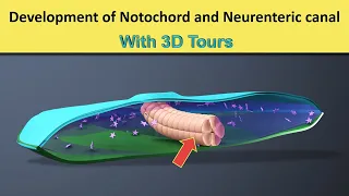 Notochord formation - Neurenteric Canal - 3D tour of Notochord & Neurenteric Canal