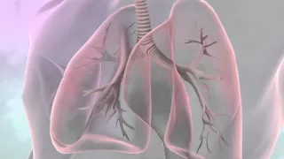 What is lung cancer? | Cancer Research UK