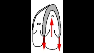 Diastolic Function Assessment by ECHO