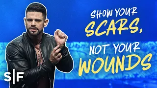 Show Your Scars, Not Your Wounds | Steven Furtick