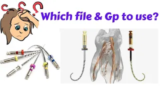 Which #endodontics  File to use in BMP Till what Number we have to prepare and which GP to use?