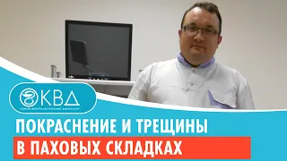 😐 Покраснение и трещины в паховых складках. Клинический случай №323