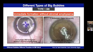 To The Wonderland - Different bubbles different troubles in Big Bubble DALK - Prof.Tarek Katamish