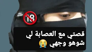 قصتي مع العصابة لي شوهو وجهي 😭 قصة حقيقية  !!