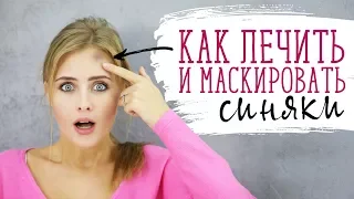 Как лечить и маскировать синяки [Шпильки | Женский журнал]