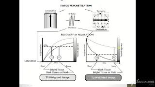 MRI Physics  Part 9 T1 ,T2 and PD اساسيات فيزياء  الرنين المغناظيسي بالعربي