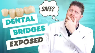 5 Things You Didn't Know About Dental Bridges (but should!)