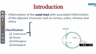 OPHTHALMOLOGY LECTURES diseases of uveal tract UVEITIS