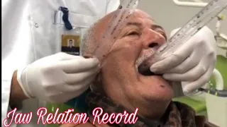 How to record Jaw Relation in Complete Denture || Clinical case