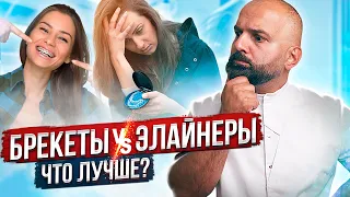 БРЕКЕТЫ или ЭЛАЙНЕРЫ?! ВСЯ ПРАВДА!