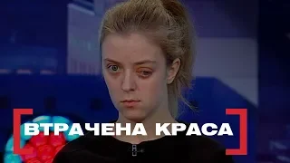 ВТРАЧЕНА КРАСА. Стосується кожного. Ефір від 28.02.2019