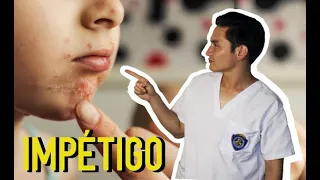 IMPÉTIGO: Infección bacteriana en niños👶👦👧