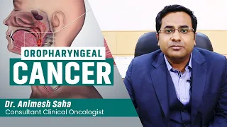 When virus is the cause of throat cancer... | Cancer treatment in Kolkata